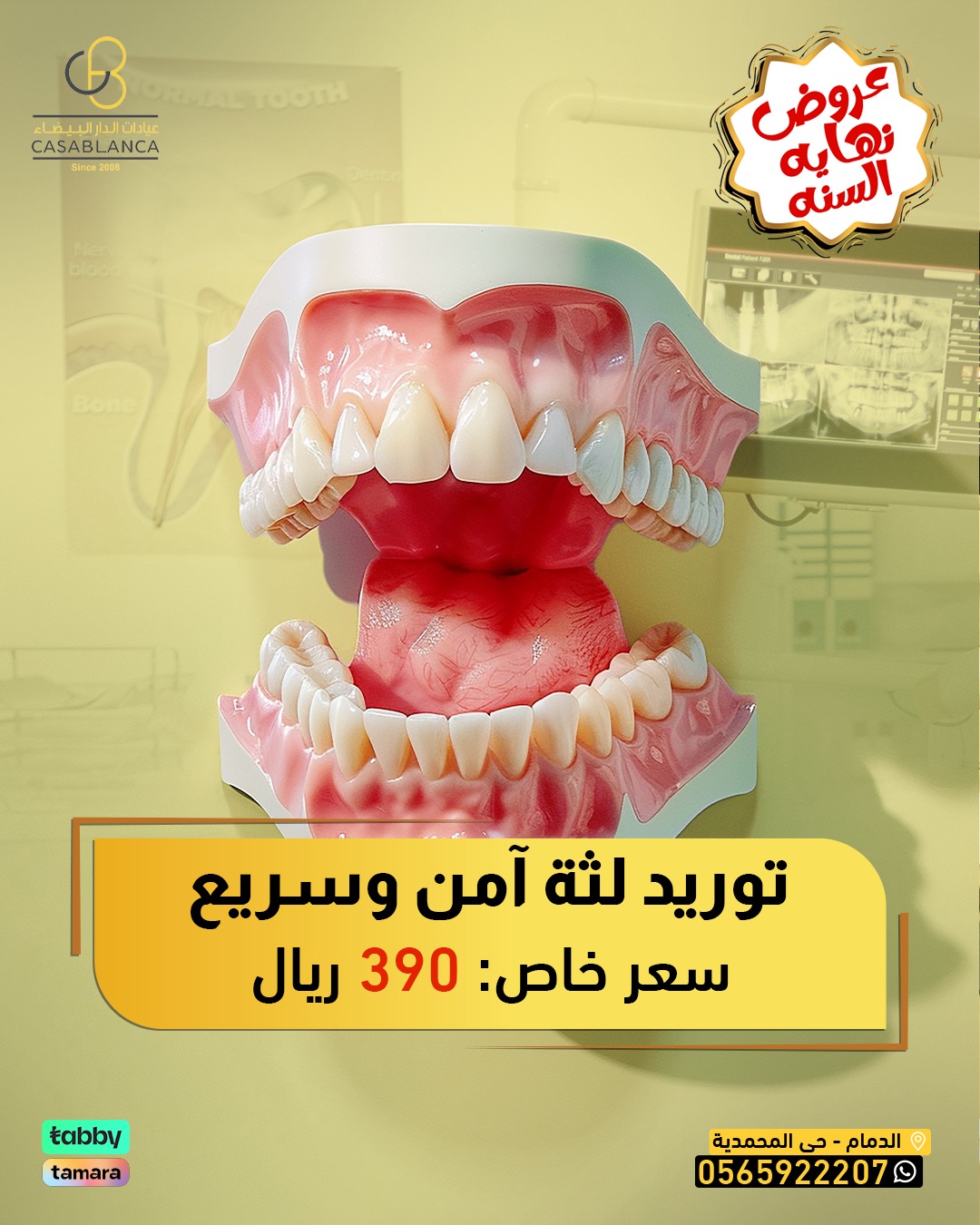 توريد اللثة ( فكين )